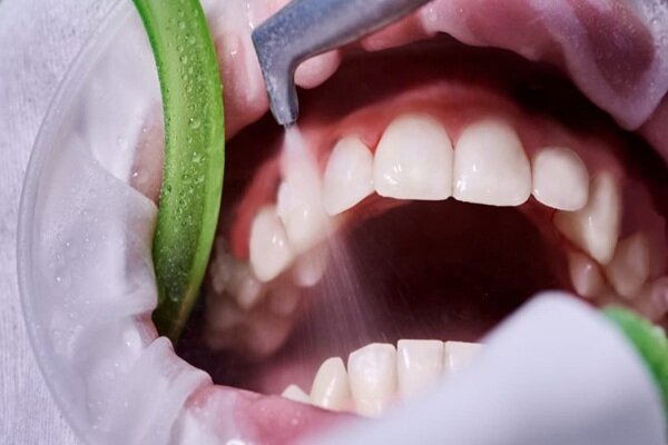 دشمن خاموش سلامت دهان