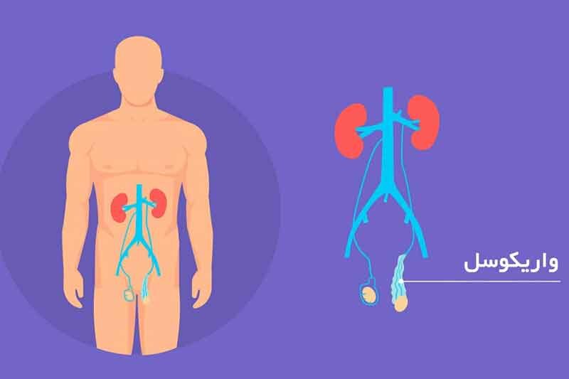 توضیحات دکتر سلمان اسلامی درباره یک عمل جراحی مردانه